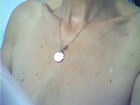 VeneRed